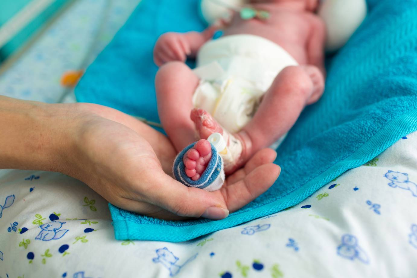 Las Consecuencias A Largo Plazo De Ser Un Bebé Prematuro